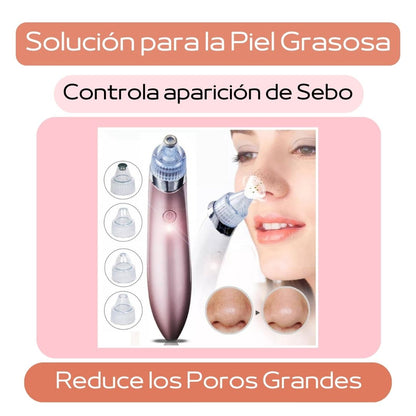 Extractor de puntos negros recargable. Efecto inmediato sin dolor. Incluye 4 cabezales de regalo